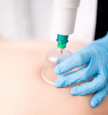 ডাঃ সাখাওয়াত - hijama,